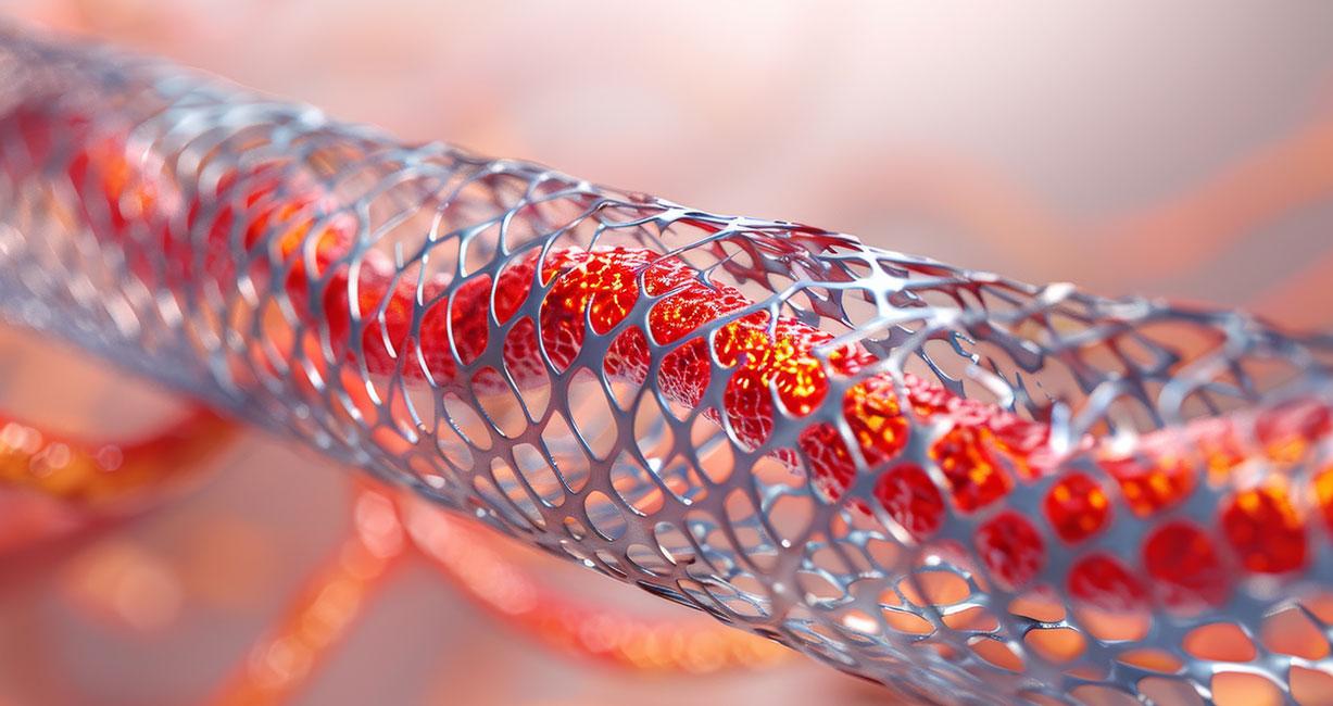 Ensuring Excellence in Biocompatibility Compliance as per the new EU MDR Standards