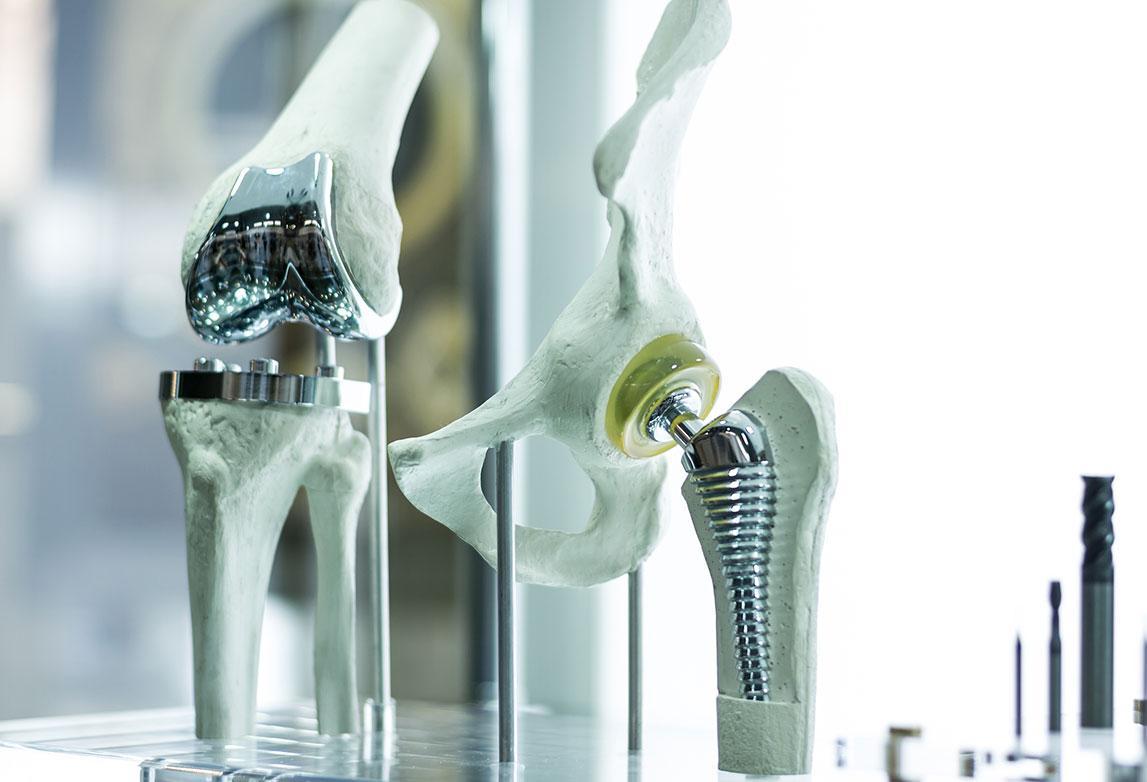 Hip Joint Implant Design