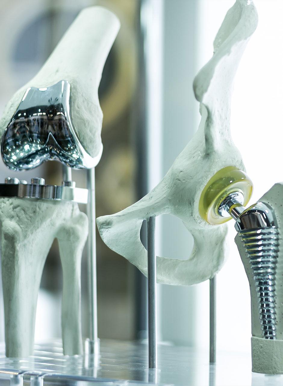 Hip Joint Implant Design