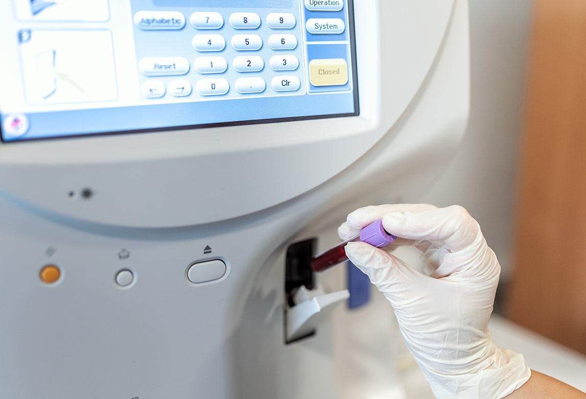 Holistic Value Engineering of Blood Coagulation Analyzer